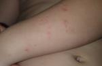 Аллергия ли? фото 2