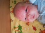Высыпания у новорожденного на лице помогите фото 4