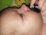 Ребенку 3 месяца пятно на щечке фото 1