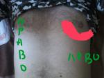 Синусовая аритмия, боль слева фото 3