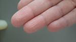 Трещины на подушечках пальцев рук фото 1