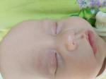 Прищика как песок на лице у младенца 3 месяца фото 2