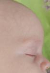 Прищика как песок на лице у младенца 3 месяца фото 3
