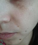 Проблемы с кожей лица, помогите! фото 1