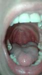 Болит горло и язык фото 1