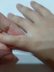 Красное пятно на пальце у ребенка фото 3