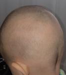 Рост волос у детей фото 2