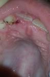 Проблемы у ребенка с зубами фото 1