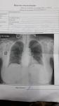 Пневмония двухсторонняя фото 1