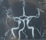 Снимок МРТ артерий мозга фото 1