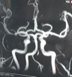 Снимок МРТ артерий мозга фото 2