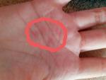 Ярко-розовое пятно на кончике пальца руки и ладони фото 1