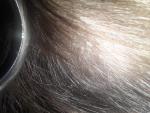 Микроспория волосистой части головы фото 2