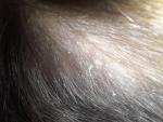 Микроспория волосистой части головы фото 1