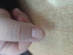 Черные полоски на ногте в виде заноз фото 2