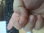 Черные полоски на ногте в виде заноз фото 3