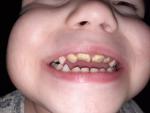 Проблемы с зубами у ребенка фото 1