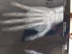 Открыты ли зоны роста по рентген снимкам кистей рук фото 2