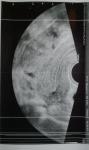 Увеличен правый яичник (фото УЗИ) фото 2