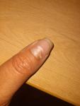 Коричневое пятно на ногте фото 2