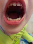 Кривые зубы постоянные фото 1
