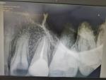 Щека боль зуб фото 1