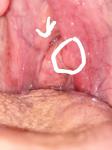 Проблемы с горлом и миндалины фото 2