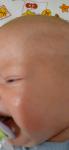 Сыпь на теле у ребенка 3 месяца фото 2