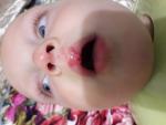 Ребенок разбил губу и опух нос фото 3