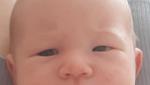 Отёчность глаз новорождённого фото 2