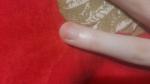 Коричневое пятно на ногте пальца руки фото 2