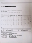 Расшифровка холтера мониторирование ЭКГ фото 3
