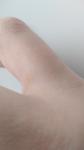 Повреждение кожи на руке фото 2
