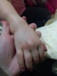 У ребенка на руке пятно телесного цвета фото 2