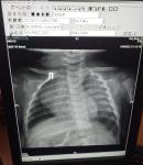 Рентген 5 месячного малыша фото 1