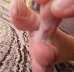 Уплотнение на пальце ноги фото 1