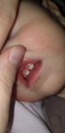 Разрушение зубов у ребенка до года, сколы, пятна на зубах фото 1