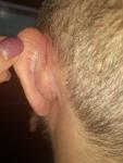 Странная кожа за ухом фото 2