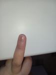 Полоса на ногте среднего пальца левой руки фото 1