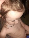 Повышенная волосатость у ребёнка фото 1