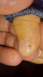 Пятнышко под ногтем у ребенка 6 лет фото 1