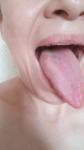 Воспаленный язык, налет фото 1