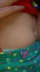 Мелкая сыпь под коленом у ребенка фото 1
