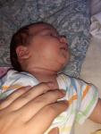 Высыпания на лице новорожденного, аллергия или акне? фото 2