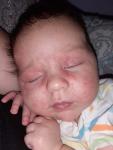 Высыпания на лице новорожденного, аллергия или акне? фото 3