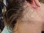Боль за ухом, воспаление, шишка фото 2