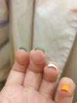 Трещины у ногтя на подушечки пальца фото 3