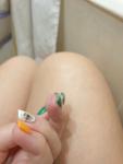 Трещины у ногтя на подушечки пальца фото 1