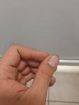 Темная полоса на ногте левой руки фото 1