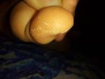 Шелушение большого пальца на ноге фото 4
